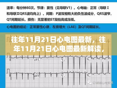 小紅書帶你解讀最新心電圖，探索健康心跳之旅