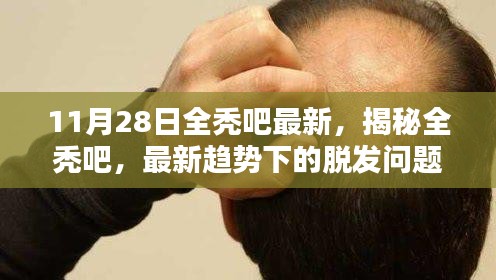 揭秘全禿吧最新趨勢，深度探討脫發問題及其解決方案