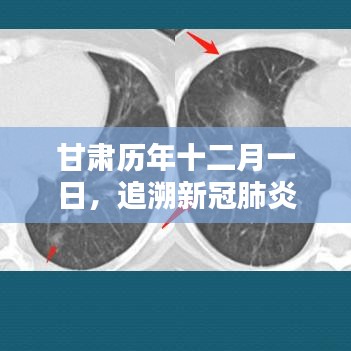 甘肅歷年十二月一日新冠肺炎足跡與影響回顧